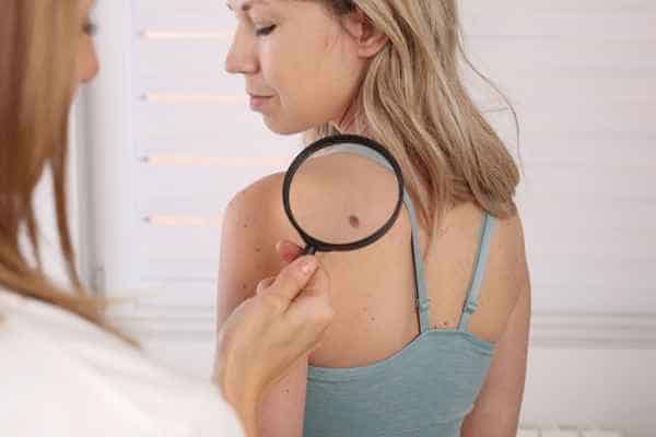 What Are Traditional Skin Lesion Removal Methods Paisley?