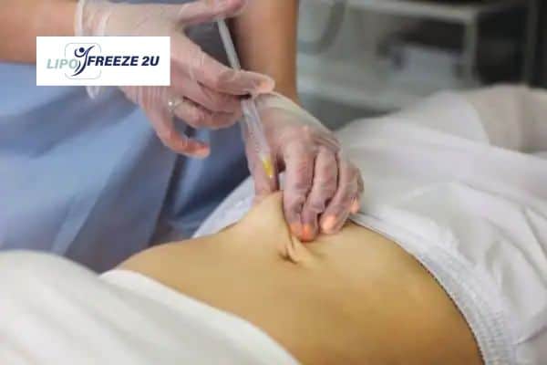 How Does Aqualyx Fat Dissolving Injection Work to Break Down Fat Paisley?
