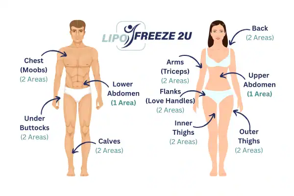 Areas you can have fat freezing treatment Paisley